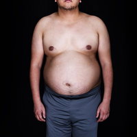 ノーガード戦法で正中線を無防備に晒すアマチュア格闘家の肉体の写真