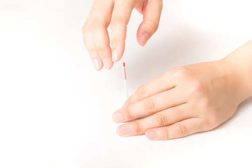 髪の毛より細い治療用の鍼を肌に当てる施術