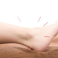 足首を中心とした鍼治療でリラクゼーションの写真