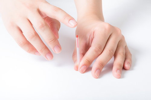 鍼灸治療を受ける患者の手と鍼を使った施術