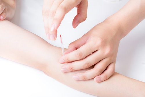 腕への鍼治療を行う施術者の手元、患者の治療部位に鍼を刺す様子