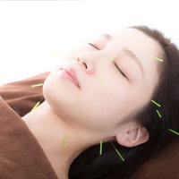 顔の美容鍼治療を受ける女性、リラックス効果の写真