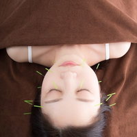 美容鍼でリラクゼーションを受ける女性の背中の写真