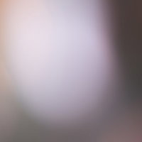 ボケた光とフレアが重なる柔らかい背景の写真