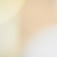 薄い黄色とオレンジ色でぼけた光のライトアップの写真
