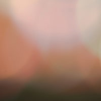 室内で撮ったシャドーの玉ボケ背景の写真