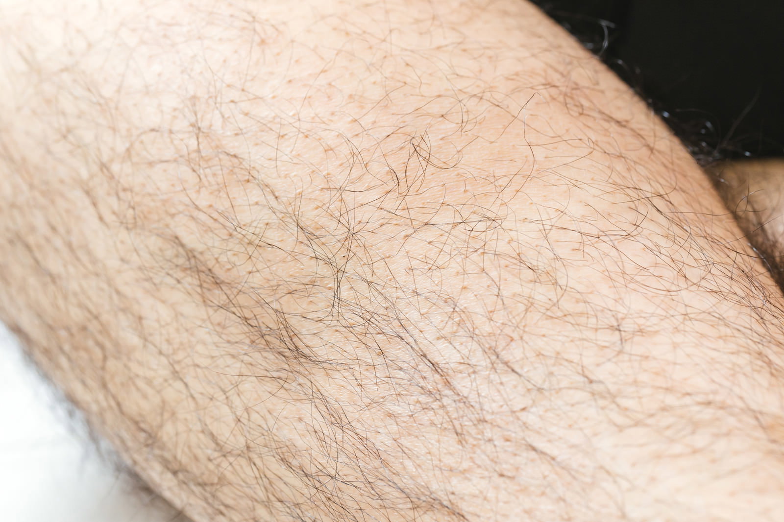 男性の足に生えた濃いすね毛をクローズアップで撮影した写真