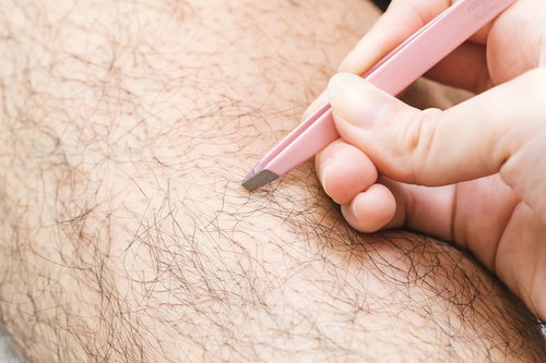 ムダ毛を自分で処理してこない毛抜きでのシェービング