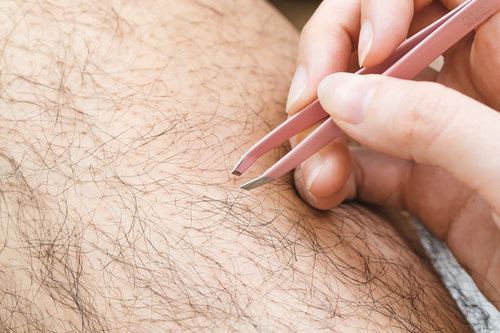 毛抜きで短く処置してからピンセットで脱毛する男性の足