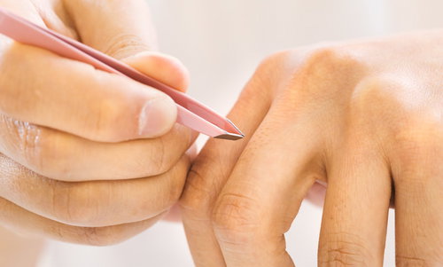 指毛をピンセット（毛抜き）で抜く手元のクローズアップ