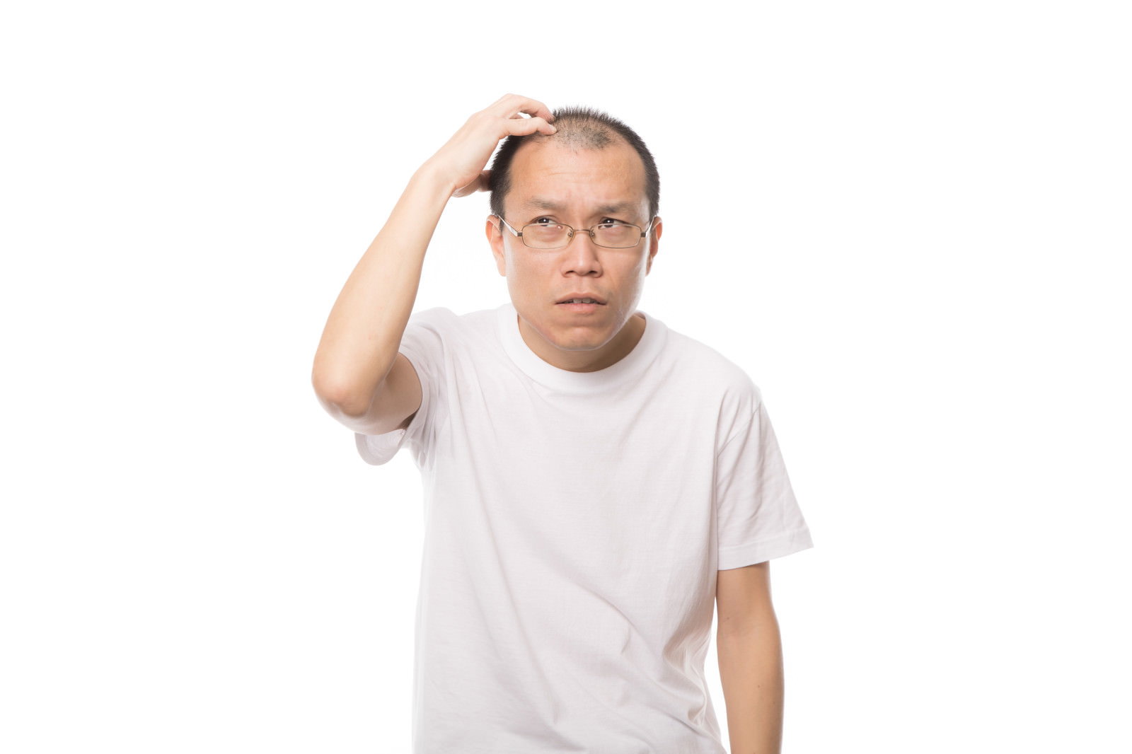 薄毛を心配して額に手を当てる白いTシャツの男性［モデル：サンライズ鈴木］
