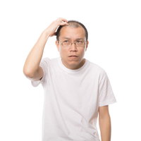 薄毛を気にして額に手を当てる男性の頭部、AGA治療や育毛の悩みの写真