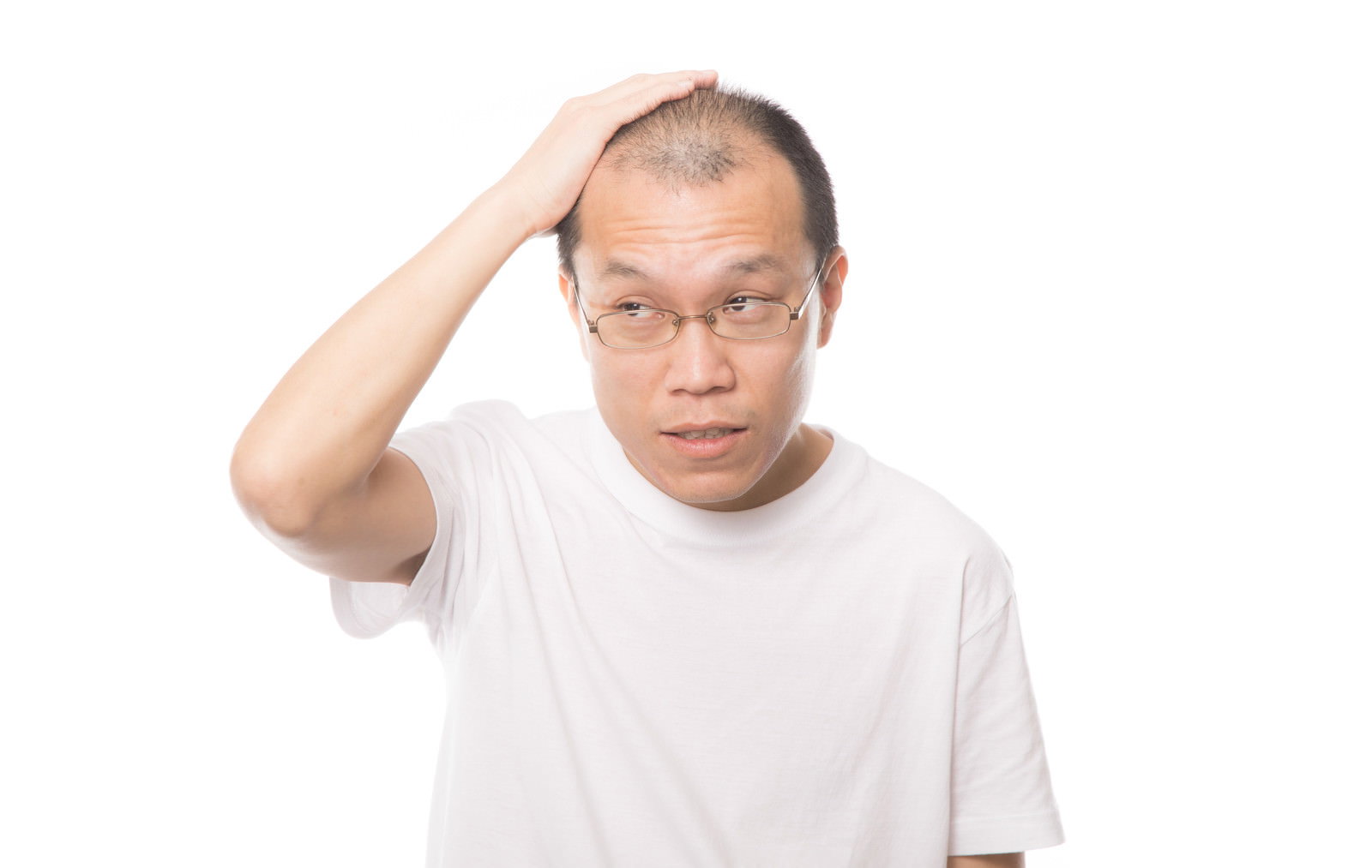 額に手を当てて悩んでいる薄毛の男性、白いTシャツ着用［モデル：サンライズ鈴木］