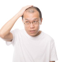 人目を気にして額を押さえるM字禿げの男性の写真