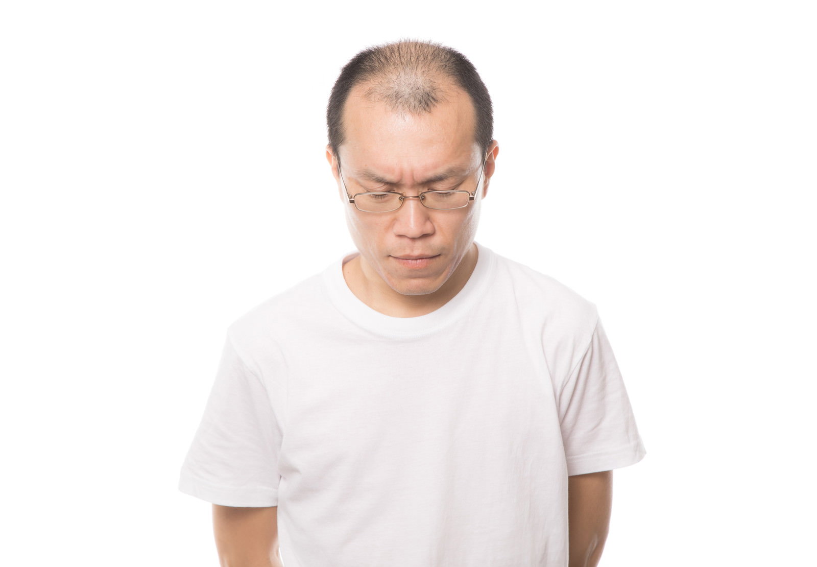 白いTシャツを着た眼鏡の中年男性が薄毛に悩み深刻な表情でうつむいている［モデル：サンライズ鈴木］