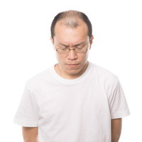 薄毛とAGAの悩みを深刻に考える眼鏡をかけた中年男性の写真