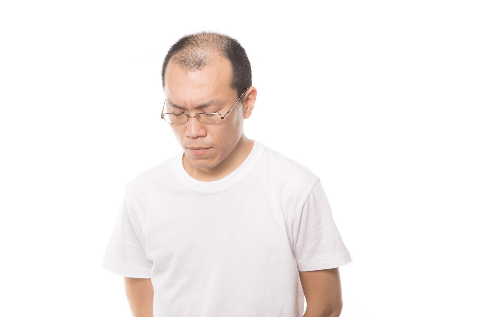 うつむく男性の頭頂部と前頭部の薄毛がわかるバストアップ写真［モデル：サンライズ鈴木］