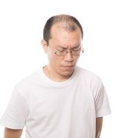 薄毛を気にして悩み苦しむ男性の頭頂部とうつむく表情の写真