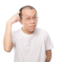 チャームポイントはM字禿げです。額に指を当てるポーズの男性の写真