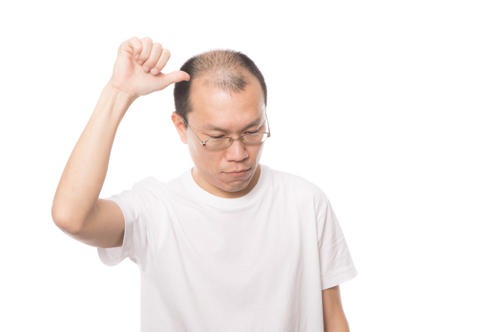 生え際を指差している白いTシャツの中年男性［モデル：サンライズ鈴木］