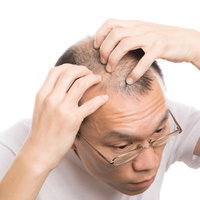 指で頭皮マッサージを行う男性の写真