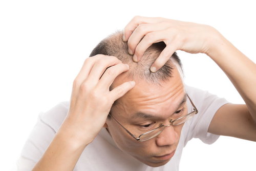 指で頭皮マッサージを行う男性