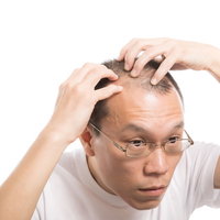 額の生え際を確認するM字ハゲを気にする男性の写真