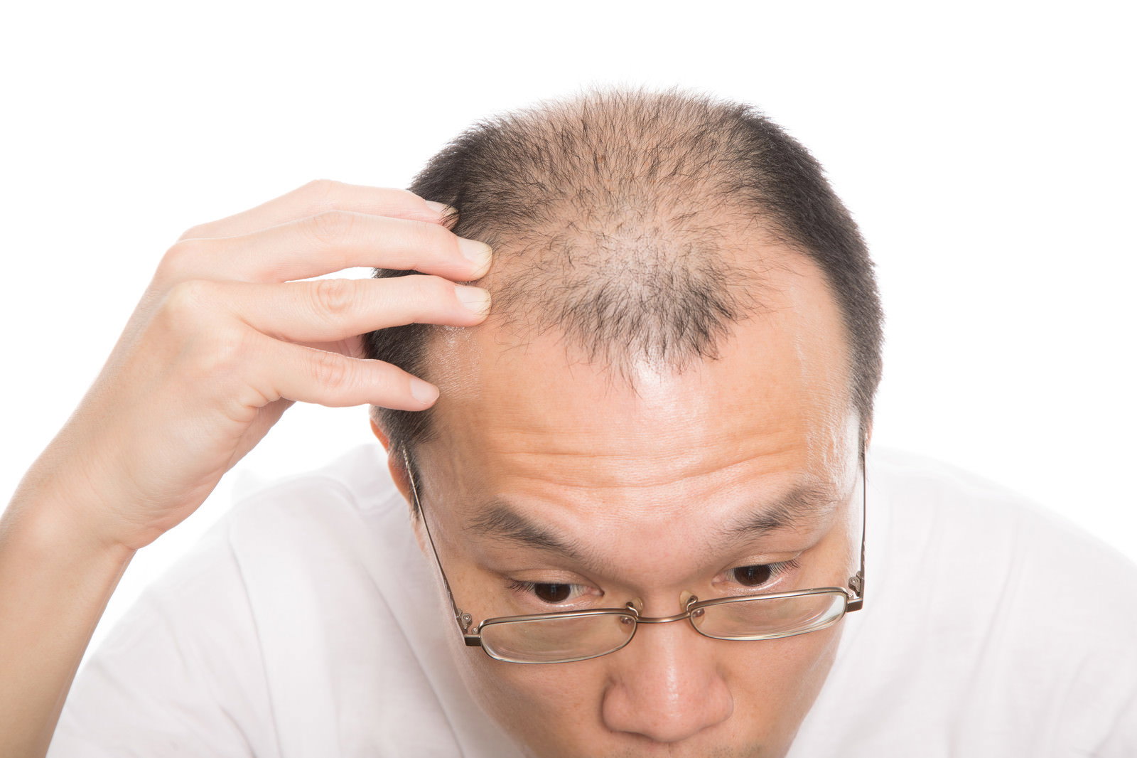 手で生え際を触りながら薄毛を気にする表情の中年男性［モデル：サンライズ鈴木］