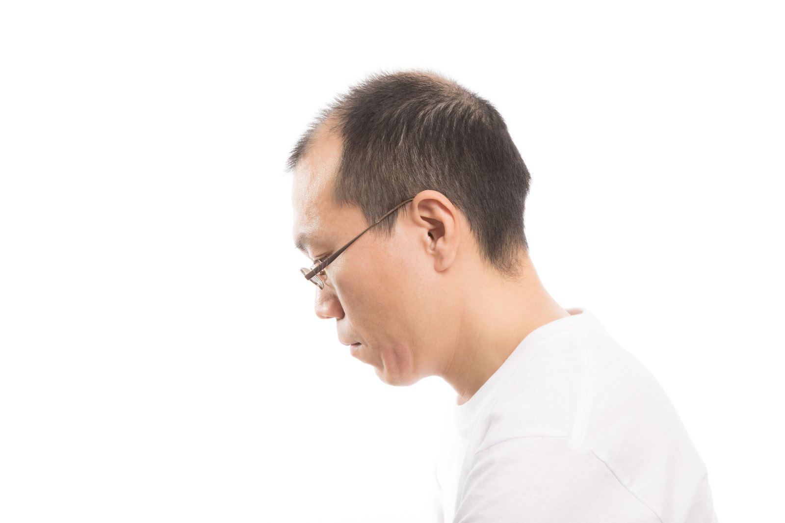 白いシャツを着た眼鏡の薄毛男性が横を向いている様子［モデル：サンライズ鈴木］