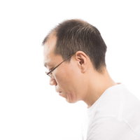 白シャツと眼鏡の薄毛男性の横顔、M字ハゲ進行中の写真