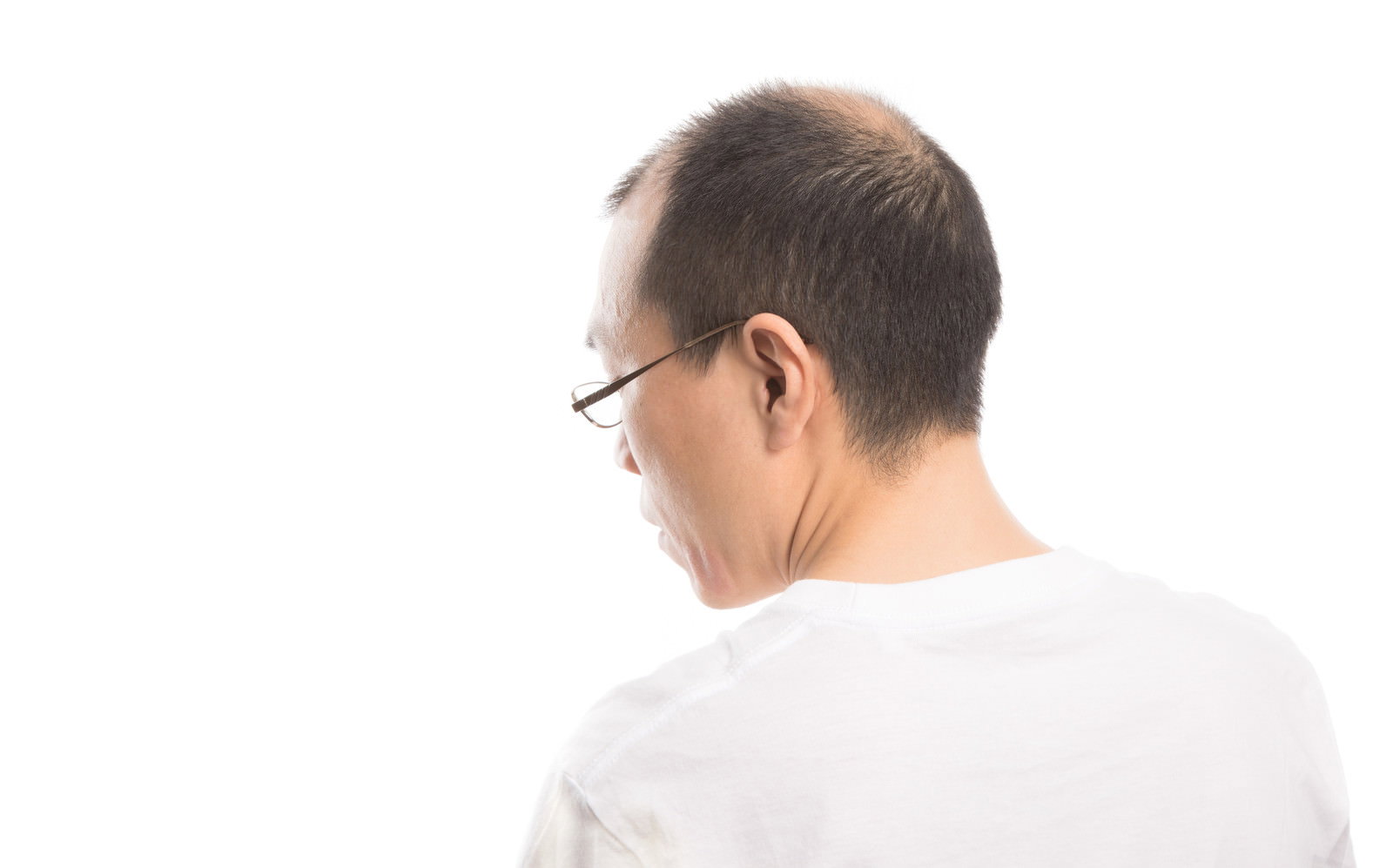 白いシャツを着た眼鏡の薄毛男性が後ろ向きに立っている様子［モデル：サンライズ鈴木］