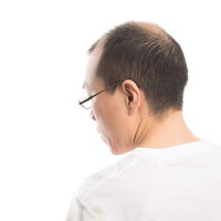 白いシャツを着た薄毛男性の後ろ姿、頭頂部が薄い状態の写真