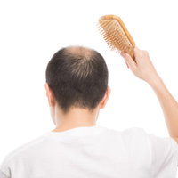 ヘアブラシで頭皮に刺激を与える薄毛男性（背後）の写真