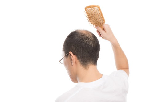 育毛促進！木製ブラシで頭皮マッサージをする薄毛男性