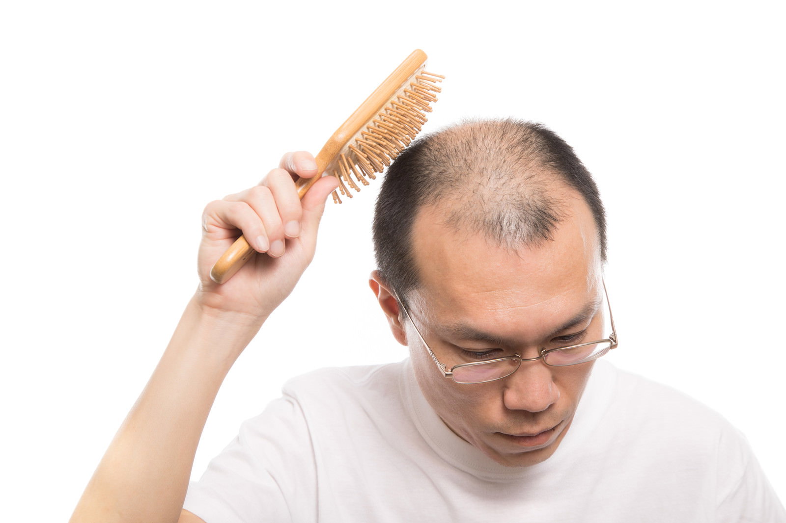育毛ブラシで頭頂部をマッサージする眼鏡をかけた薄毛男性［モデル：サンライズ鈴木］