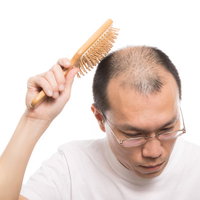 頭頂部を育毛ブラシでトントンマッサージする薄毛男性の写真