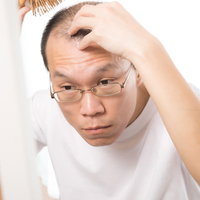 毎日欠かさない頭皮ケアに悩む男性の様子と薄毛対策の写真