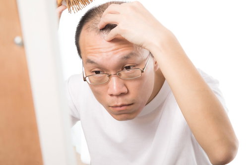 毎日欠かさない頭皮ケアに悩む男性の様子と薄毛対策