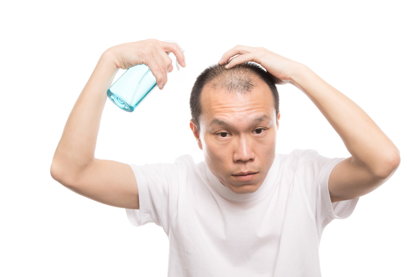 白いTシャツを着た薄毛の男性がトニックスプレーを頭皮に噴射している［モデル：サンライズ鈴木］