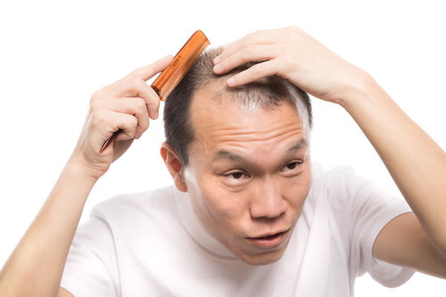 薄毛やAGA、ハゲを気にして櫛を持つ男性