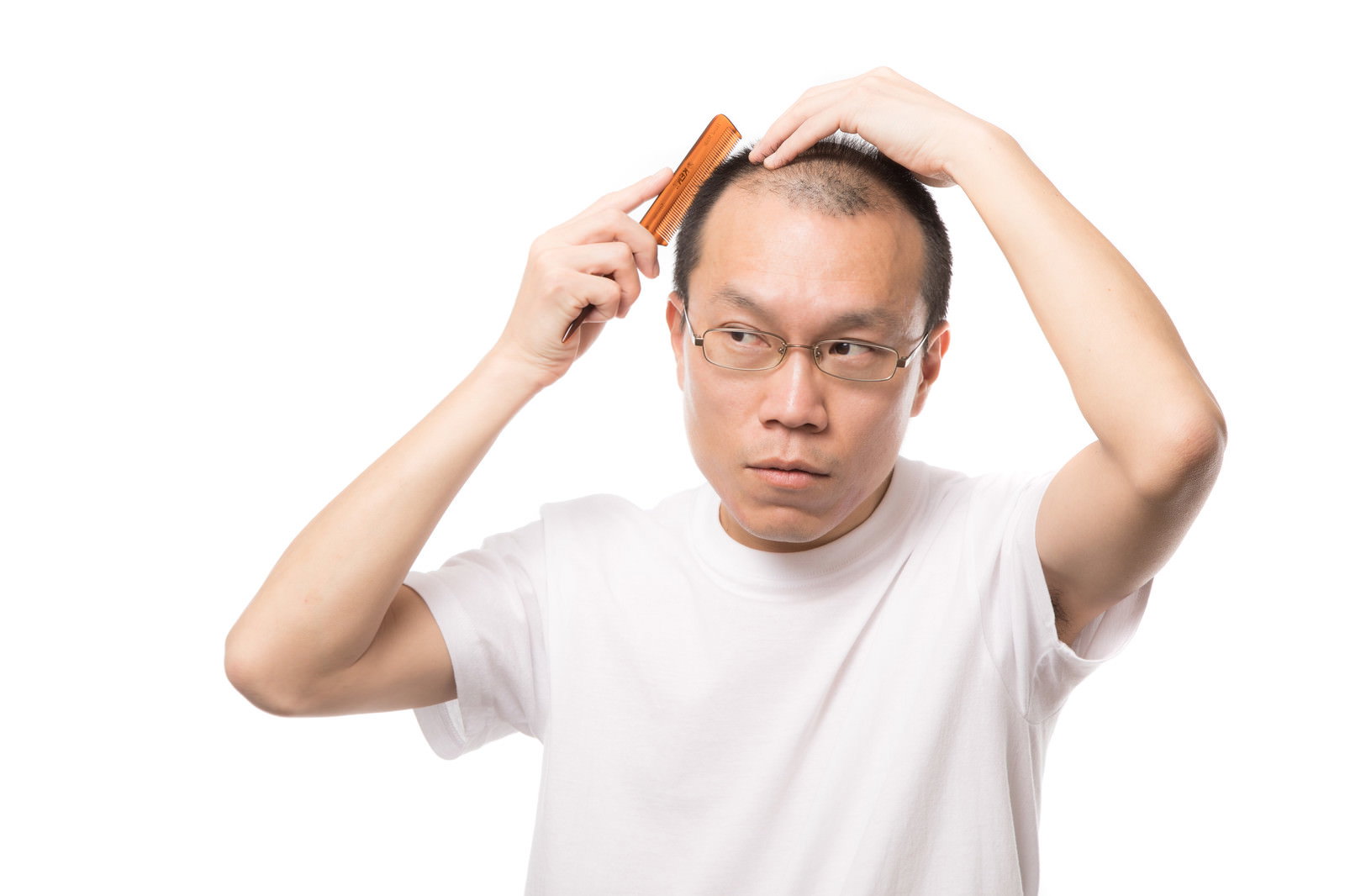M字ハゲで両手で頭を抱える眼鏡をかけた白Tシャツの中年男性［モデル：サンライズ鈴木］