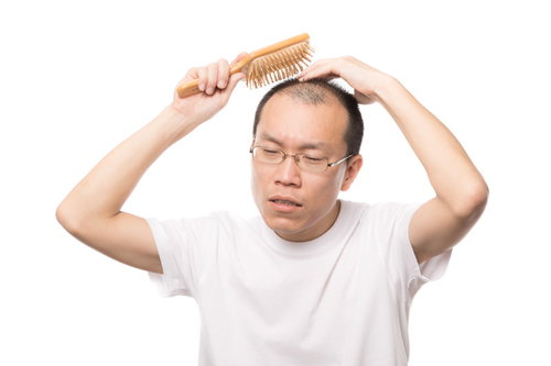 育毛ブラシで頭部をマッサージする薄毛男性