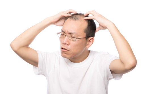セルフ頭皮マッサージをする男性の薄毛対策