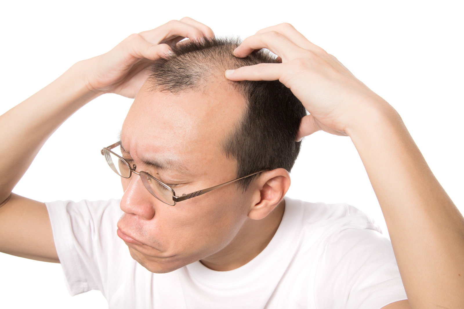 両手で頭部を押さえながらセルフ指圧をする薄毛の眼鏡男性