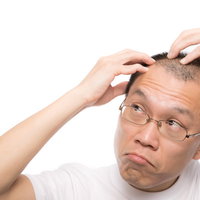 M字の生え際が気になる男性が鏡を見て頭部を触るの写真