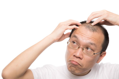 M字の生え際が気になる男性が鏡を見て頭部を触る