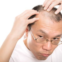 おでこが広いM字ハゲの男性が鏡で頭頂部を確認の写真