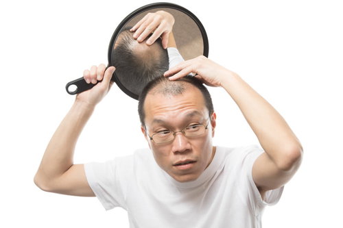 手鏡で頭頂部をヘアチェックする薄毛男性の抜け毛対策