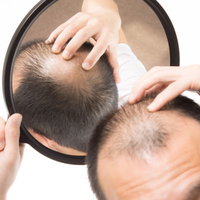 頭頂部のO型禿げを手鏡で確認するAGA男性のセルフチェックの写真
