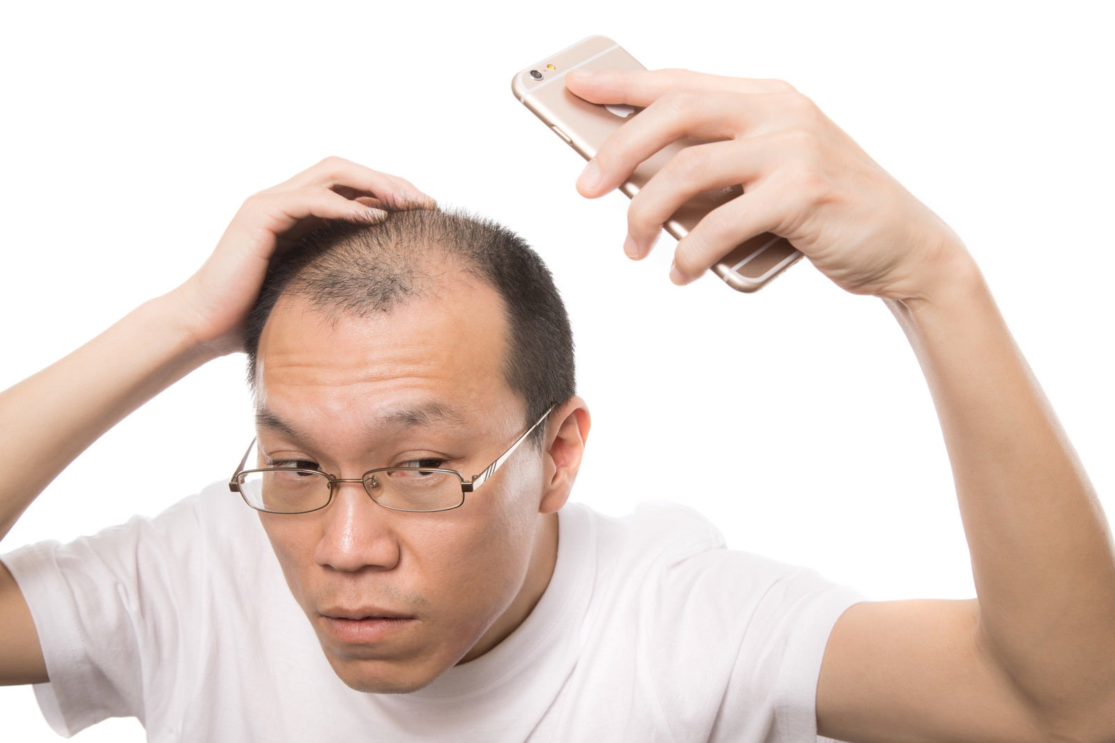 スマートフォンで自撮りしながら薄毛をチェックする白シャツの男性［モデル：サンライズ鈴木］